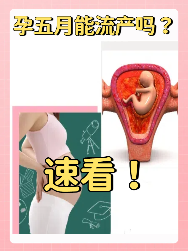 孕妇生孩子小游戏-第2张图片