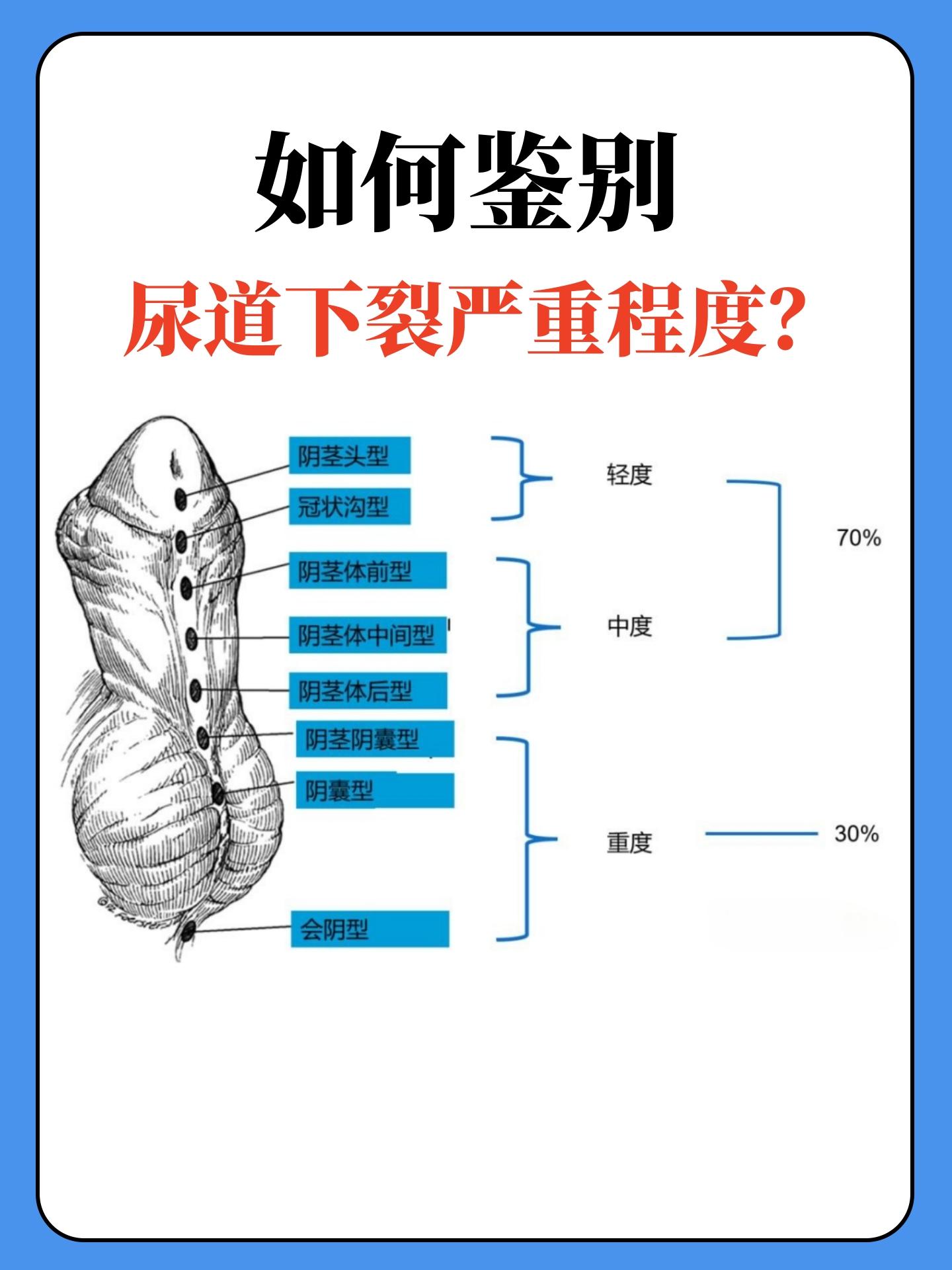 让男人玩尿道的女人玩弄男人尿道的女人，背后的秘密与道德困境