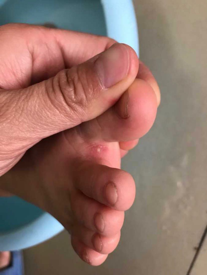 丫头腿张大一点就不疼了-第2张图片