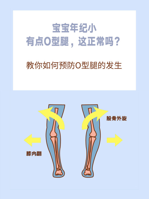 宝宝双腿交叉使劲用力什么症状宝宝双腿交叉使劲用力可能的症状