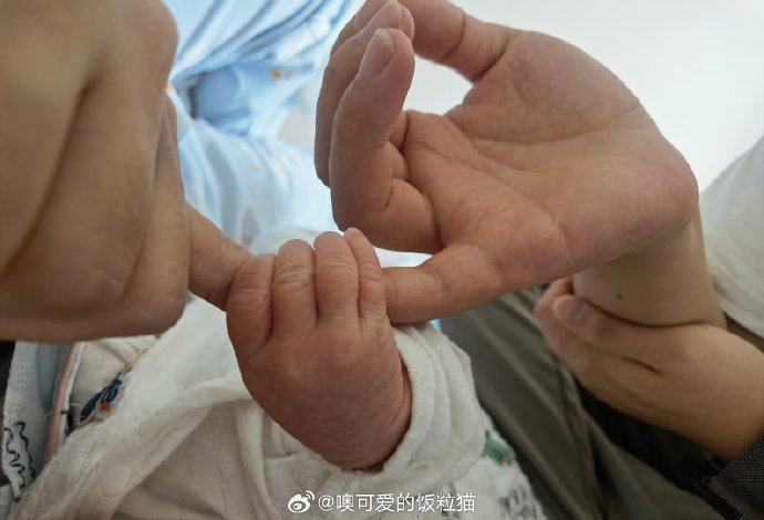 最小的小宝宝有多小BB最小有多大-第3张图片