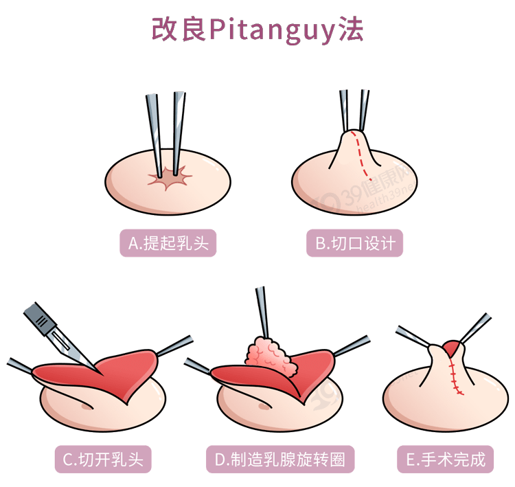 在厨房里两只乳头被吸肿了厨房里的乳头肿胀-第1张图片