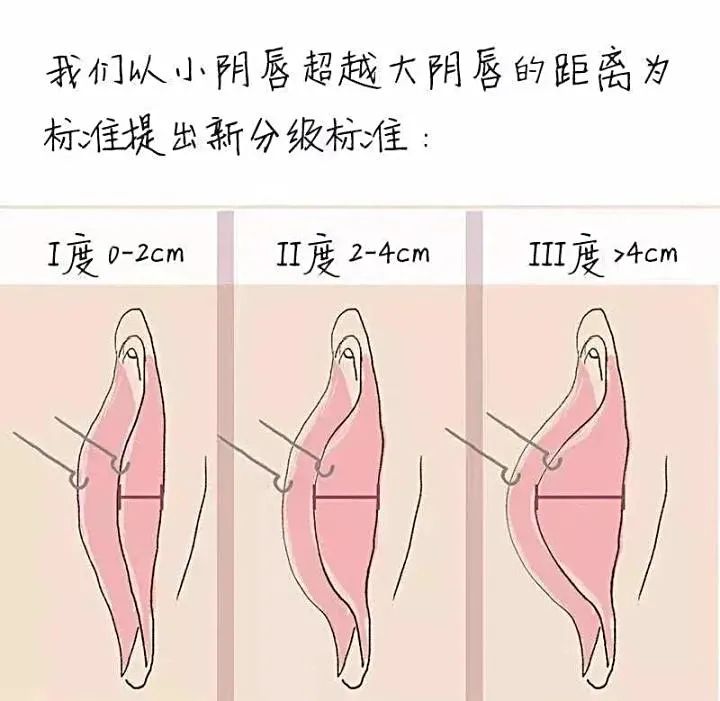 女人底下图片女人私密之美，探索女性下体的神秘世界